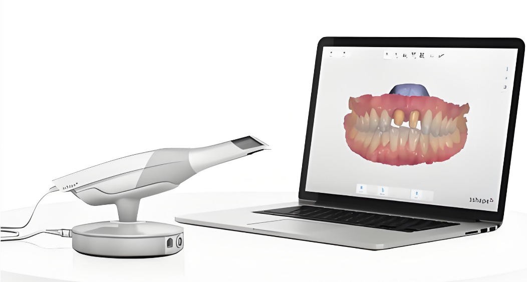 濾光片 三維口內掃描儀